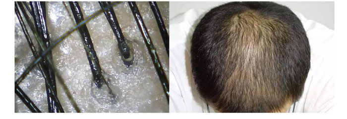 ���ϼ���-ɽ�����{(di��o)������