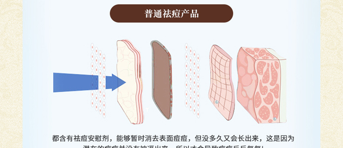 �琂�òݱ�ֲ����M��